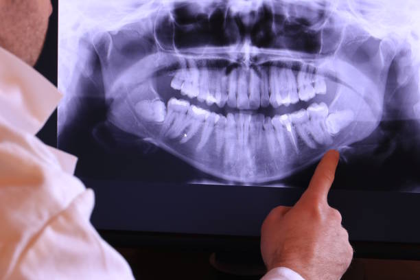 Best Emergency Dental Care for Broken or Chipped Teeth in Littlerock, CA