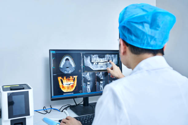 Best Emergency Wisdom Teeth Removal in Littlerock, CA